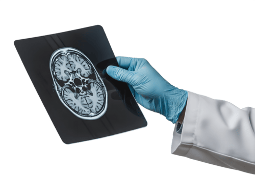 Memory and Neuro Health